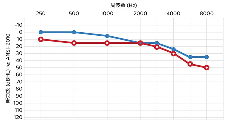 hearing_level_ansi-2010_750_400_cn